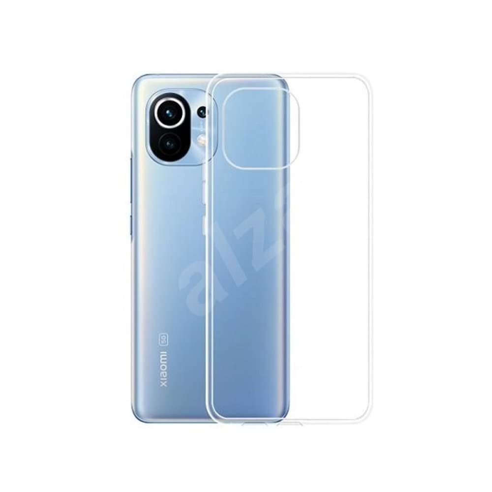 Xiaomi Mi 11 Kılıf Lüx  Silikon resmi